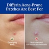 Differin Acne Patches, Pimple Patches for Acne Prone Skin, Formulated with Salicylic Acid and Centella, Fast Triple Action Power Patch for Day & Night, Dermatologist Tested, 36 Count(36 Count (Pack of 12))