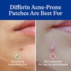 Differin Acne Patches, Pimple Patches for Acne Prone Skin, Formulated with Salicylic Acid and Centella, Fast Triple Action Power Patch for Day & Night, Dermatologist Tested, 36 Count(36 Count (Pack of 12))