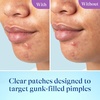 Differin Power Pimple Patches, Hydrocolloid Acne Treatment, 23 ct
