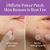 Differin Power Pimple Patches, Hydrocolloid Acne Treatment, 23 ct