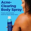 Differin Acne Body Spray, Acne Treatment with Salicylic Acid by the makers of Differin Gel, 360 Formula for Back Acne, Chest and Shoulders, 6 oz | 360 Degree Spray Targets Back, Chest, Shoulders, Salicylic Acid Body Acne Treatment, Dermatologist-Developed, 6 Oz